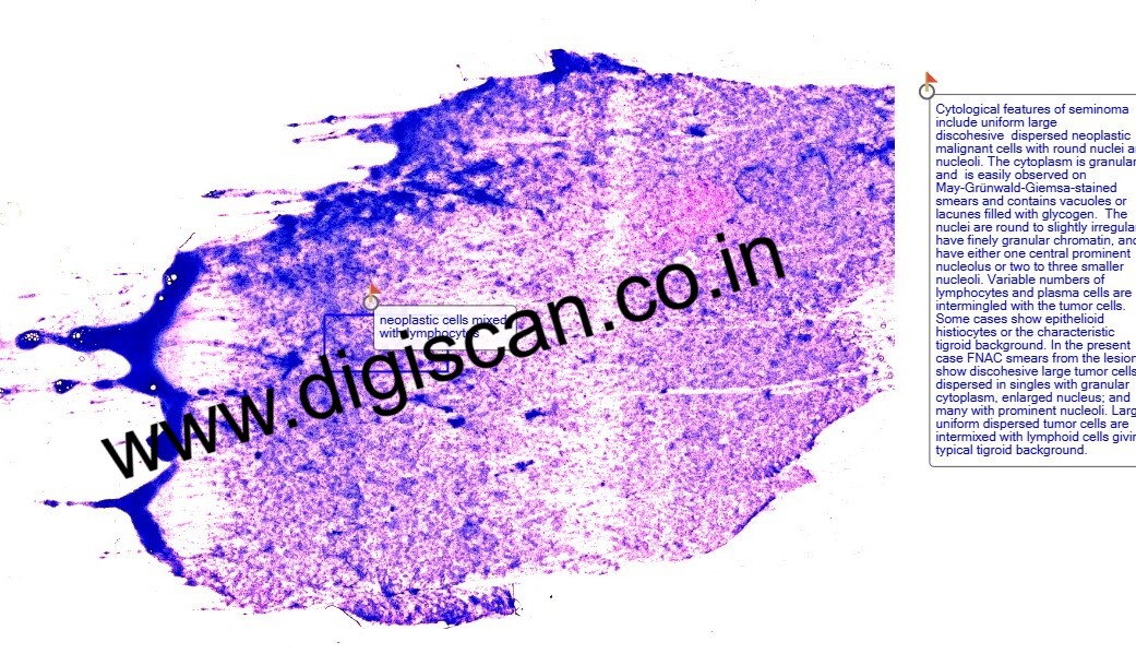 Fine Needle Aspiration Cytology (FNAC) Digital Slides Set
